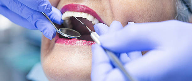 Best Emergency Treatment for Dental Infections or Abscesses in Raytown, MO
